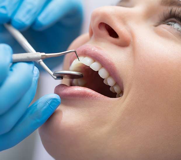 Carpinteria Dental Bonding