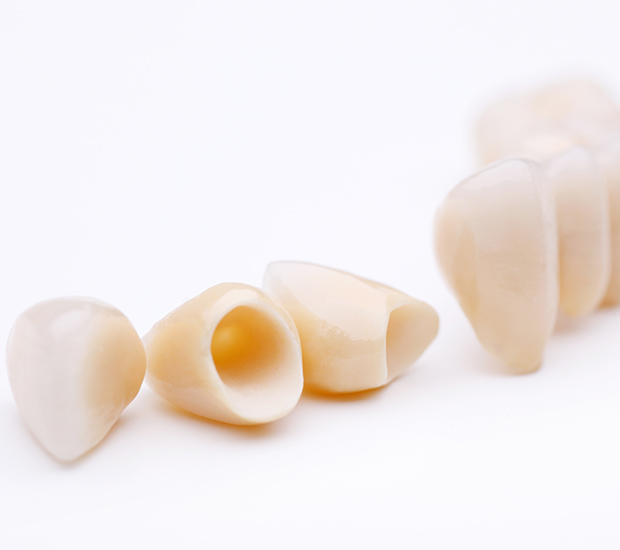 Carpinteria Dental Crowns and Dental Bridges
