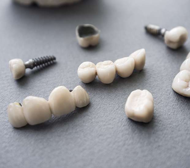 Carpinteria The Difference Between Dental Implants and Mini Dental Implants