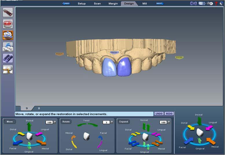 Same Day Dentistry Model